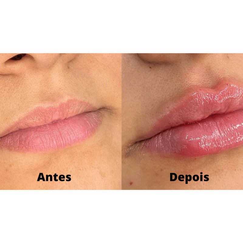 Gloss Preenchedor Derol – Volume Instantâneo e Impermeável