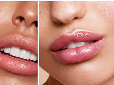 Gloss Preenchedor Derol – Volume Instantâneo e Impermeável